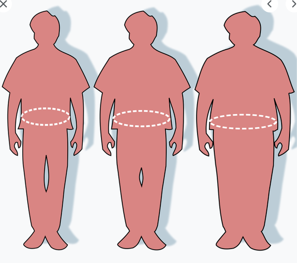 obesity